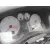 PEUGEOT 307 BERLINA (S2) PEUGEOT 307 BERLINA (S2) '2007 D-SIGN GRIS 2006
