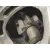 Motor Arranque para Chrysler Neon (Pl)